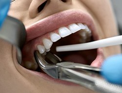 Woman smiling while flossing her teeth