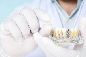 Dentist showing off a tray of dental implants